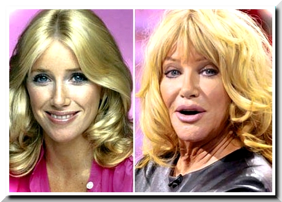 Suzanne Somer Never Admits It Even It’s Obvious